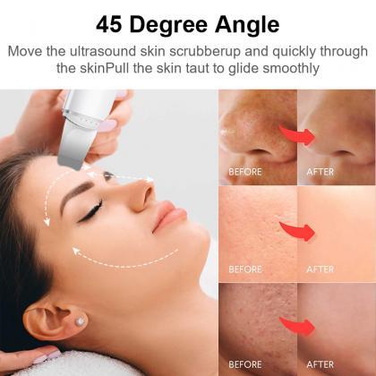 Ultrasonic Skin Scrubber Vibration Face Spatula..