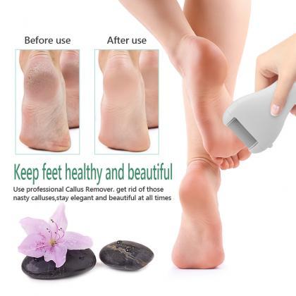 Charged Electric Foot File For Heels Grinding..